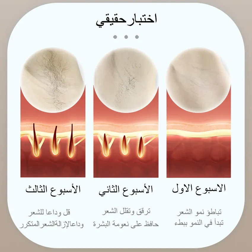 جهاز إزالة الشعر بالليزر MLAY T14 بتقنية IPL جهاز إزالة الشعر بالليزر MLAY T14 بتقنية IPL